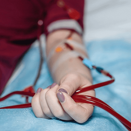 tratamento acessos vasculares angiolink