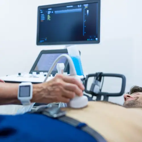 Exames Complementares - Eco Doppler Vascular - Angiolink